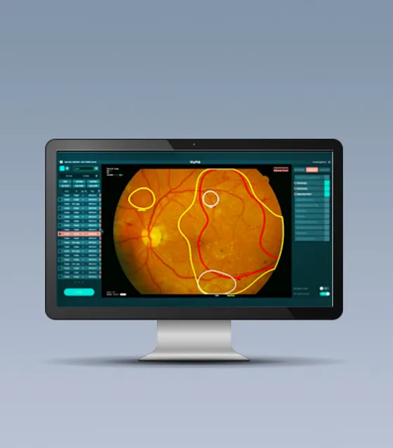 VUNO Fundus AI ai fundus examination used at Sky Eye Clinic