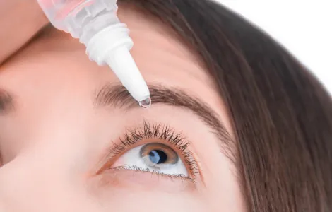 Woman applying eye drops, the basic medical treatment to lower eye pressure in glaucoma