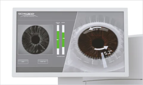 Laser screen showing eye rotation being measured and corrected before treatment